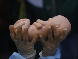 Miniatura: Z aborcją na sztandarze